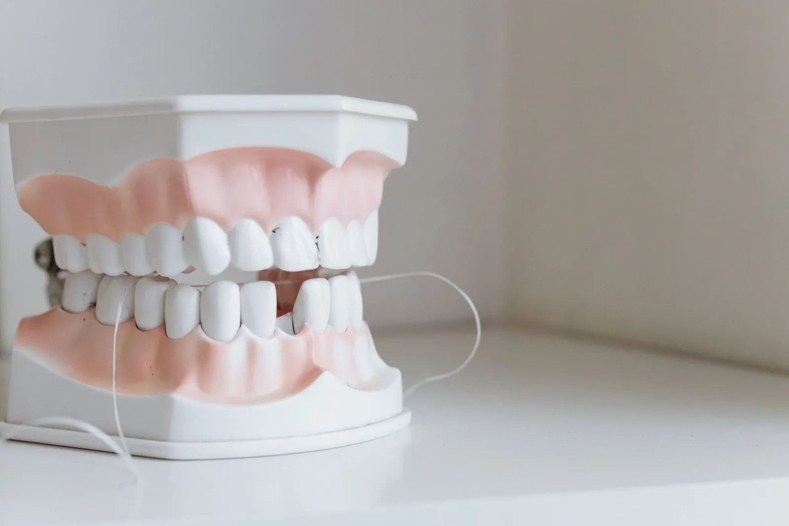 Modello di arcata dentale